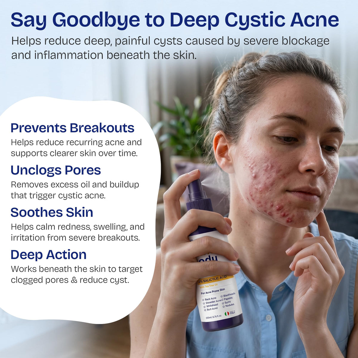 Body Acne Spray | Back Acne Treatment for Face, Body, Shoulder & Butt | Acne Body Spray for Blackheads & Whiteheads